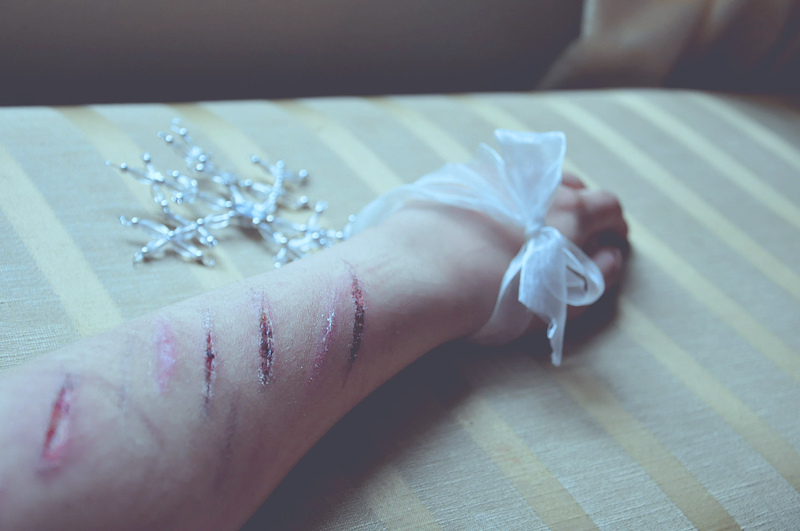 Self Harm - Photo by: 3 0 d a g a r m e d a n a l h u s - Source: Flickr Creative Commons